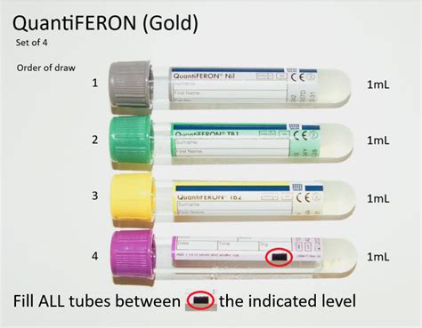 quantiferon tube color|quantiferon tb gold drawing instructions.